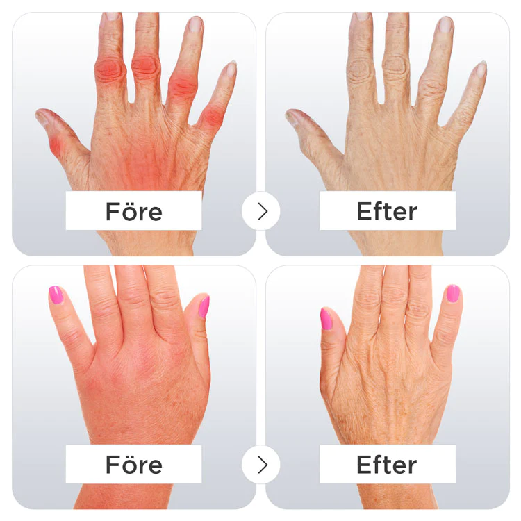 Artritt kompresjonshansker