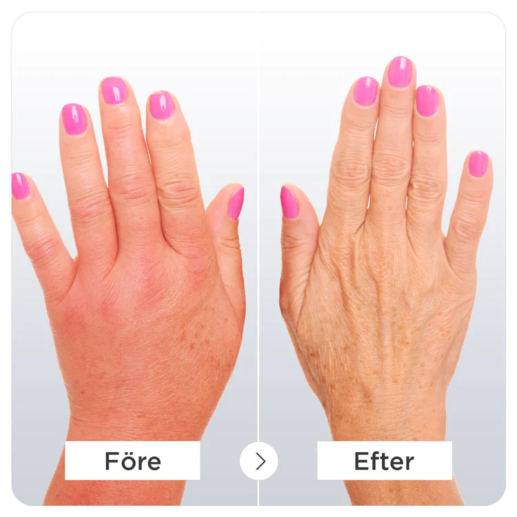 Artritt kompresjonshansker