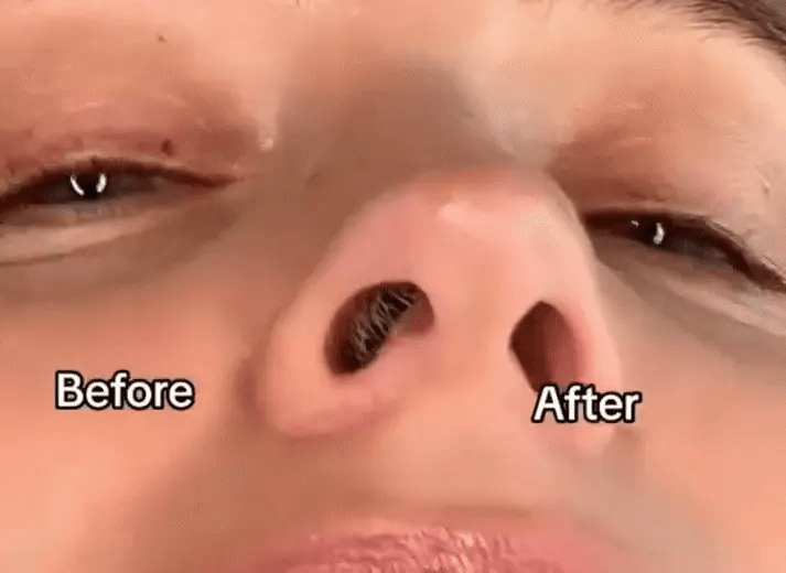 MiniTrim Precision: Nese, ører og bryn!