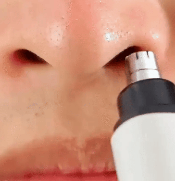 MiniTrim Precision: Nese, ører og bryn!