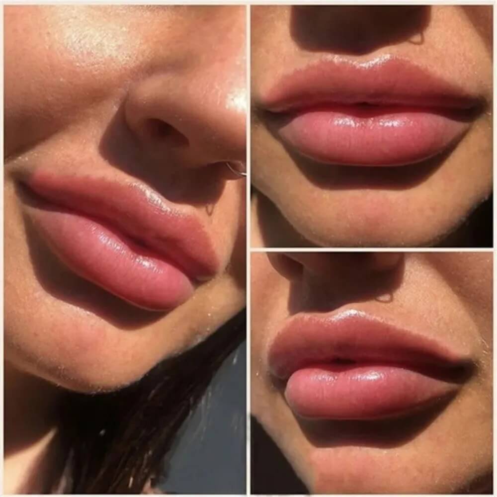 LipMax - Umiddelbar Volumgivende Leppeserum for Fyldigere og Plumpere Lepper